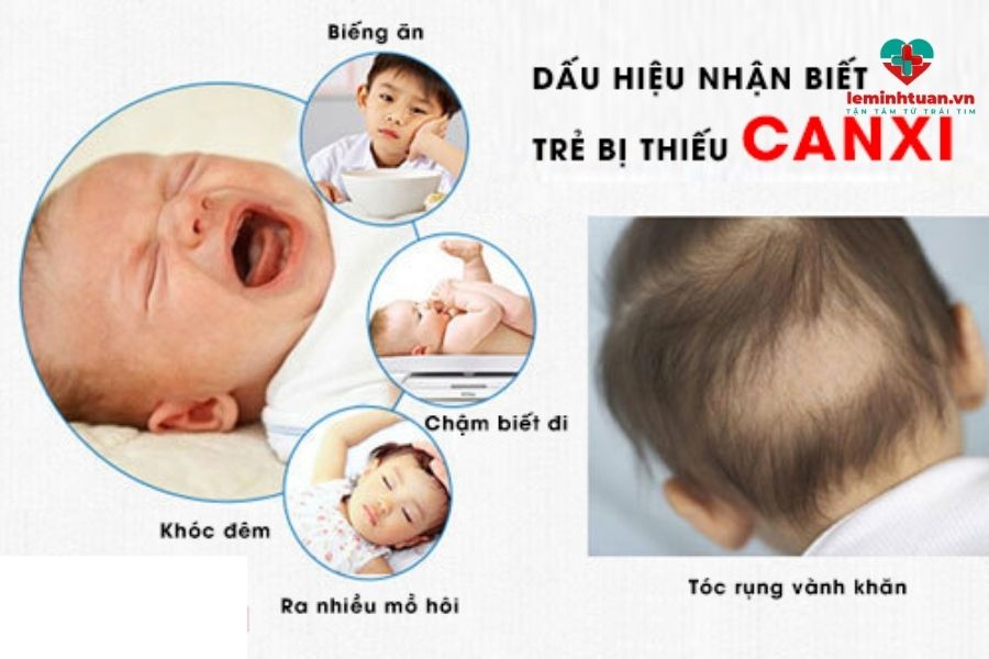 Tại sao cần bổ sung canxi cho trẻ sơ sinh? Biểu hiện của trẻ sơ sinh thiếu canxi