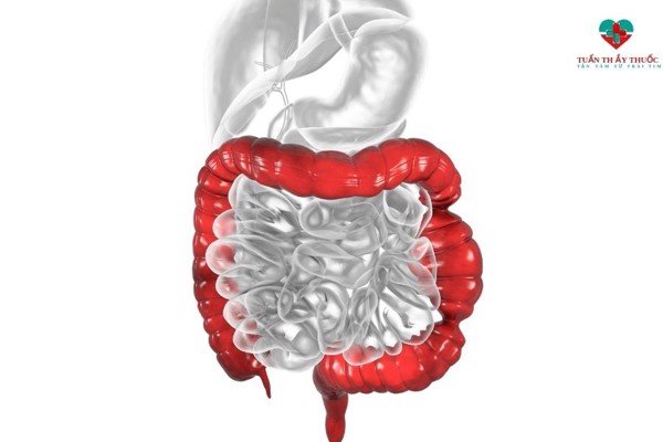 Trẻ mắc triệu chứng kích thích ruột nguyên nhân do đâu? – Mẹ cần biết