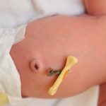 Dấu hiệu bé sắp rụng rốn mẹ nên biết để vệ sinh rốn cho con đúng cách