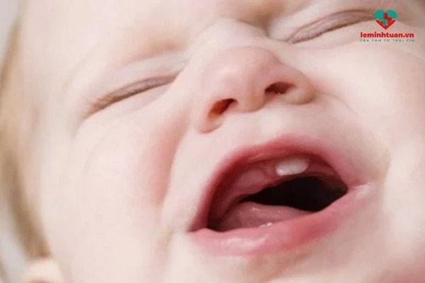 Trẻ 2 tuổi quấy khóc không rõ nguyên nhân cảnh báo điều gì?