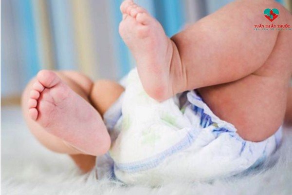 Bé sơ sinh đi ngoài nhiều lần trong ngày nguyên nhân và điều trị