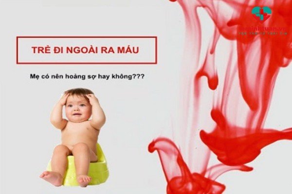 Trẻ bị táo bón đi ngoài ra máu không biết cách xử lý vô cùng nguy hiểm
