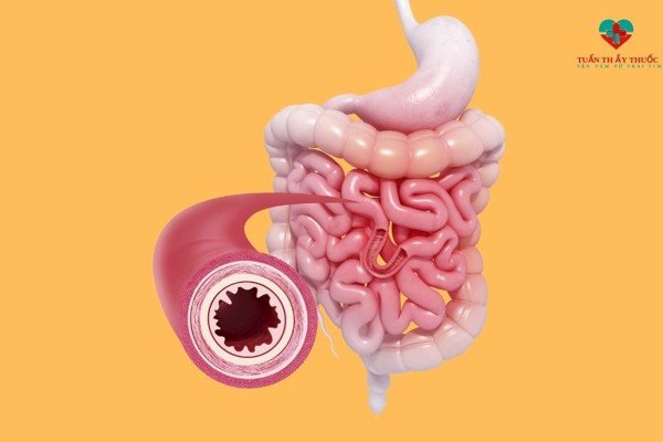 Trẻ ăn nhiều nhưng vẫn bị sụt cân – Lời khuyên từ chuyên gia dinh dưỡng