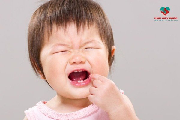 Trẻ biếng ăn phải làm sao bác sĩ điểm mặt nguyên nhân bé hay gặp